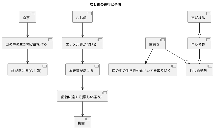 むし歯とは